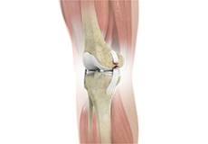 Knee Ligament Injuries